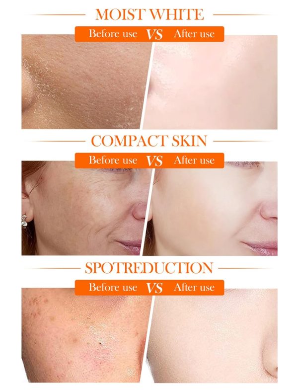 Whitening Cream | Vitamin C Hydrating Face Cream – Glowing & Repairing Moisturizer For Fine Lines, Wrinkles & Uneven Skin Tone
